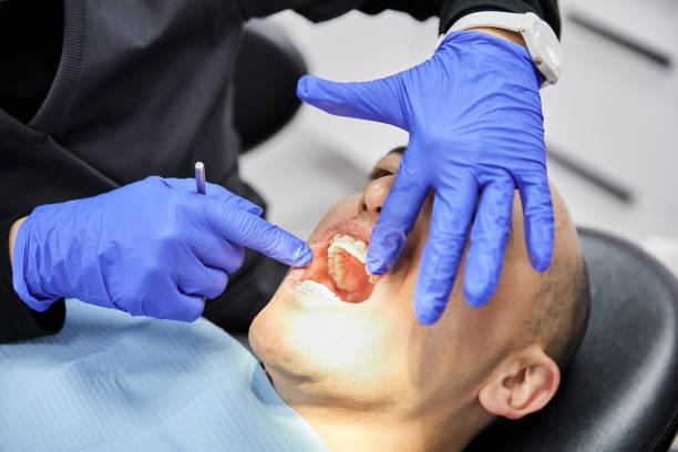 Best Broken or Cracked Tooth Emergency Dentist in Dunnstown, PA